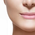 How long does it take for restylane to take full effect?