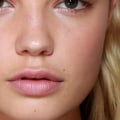 How Much Do Restylane Lip Injections Cost?