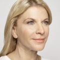 What to Expect After Restylane Treatment