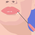 The Evolution of Facial Fillers: From Paraffin to Microcannulas