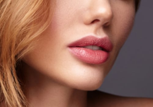 What are the Benefits of Restylane Refyne Injections?