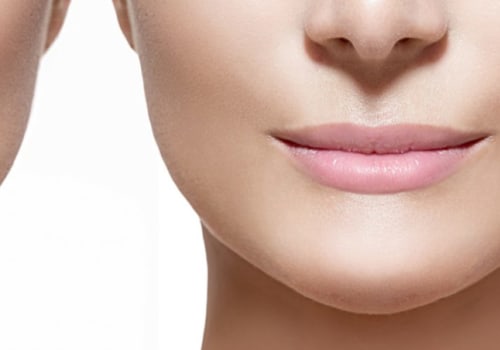 Is it normal to have lumps after restylane?