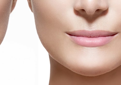 How Long Does it Take for Restylane to Settle?
