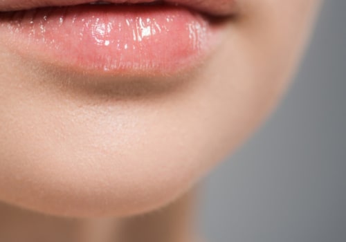 How Long Does it Take for Restylane to Settle?