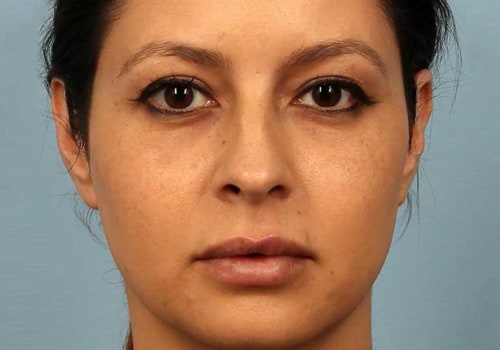 What Lasts Longer: Botox or Restylane?
