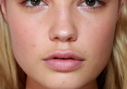 How much are restylane lip injections?