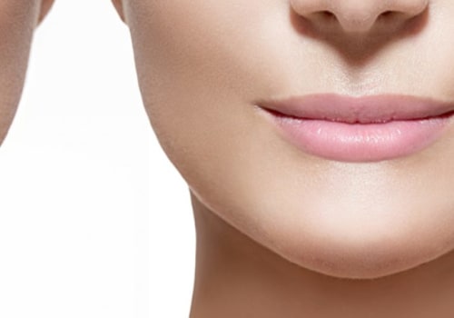 Does restylane improve over time?