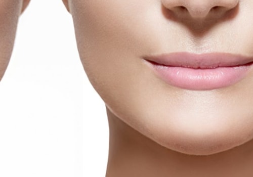 Will Lumps from Restylane Disappear?