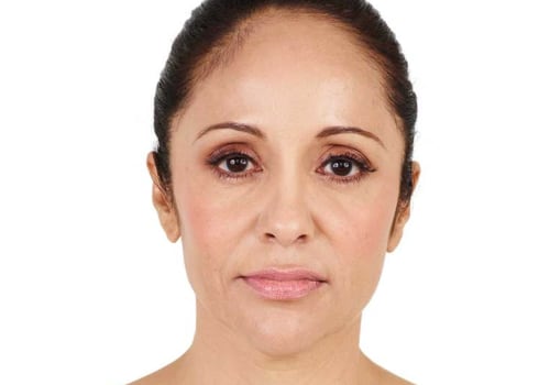What is Restylane Made Of?