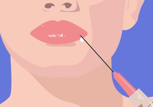 The Evolution of Facial Fillers: From Paraffin to Microcannulas